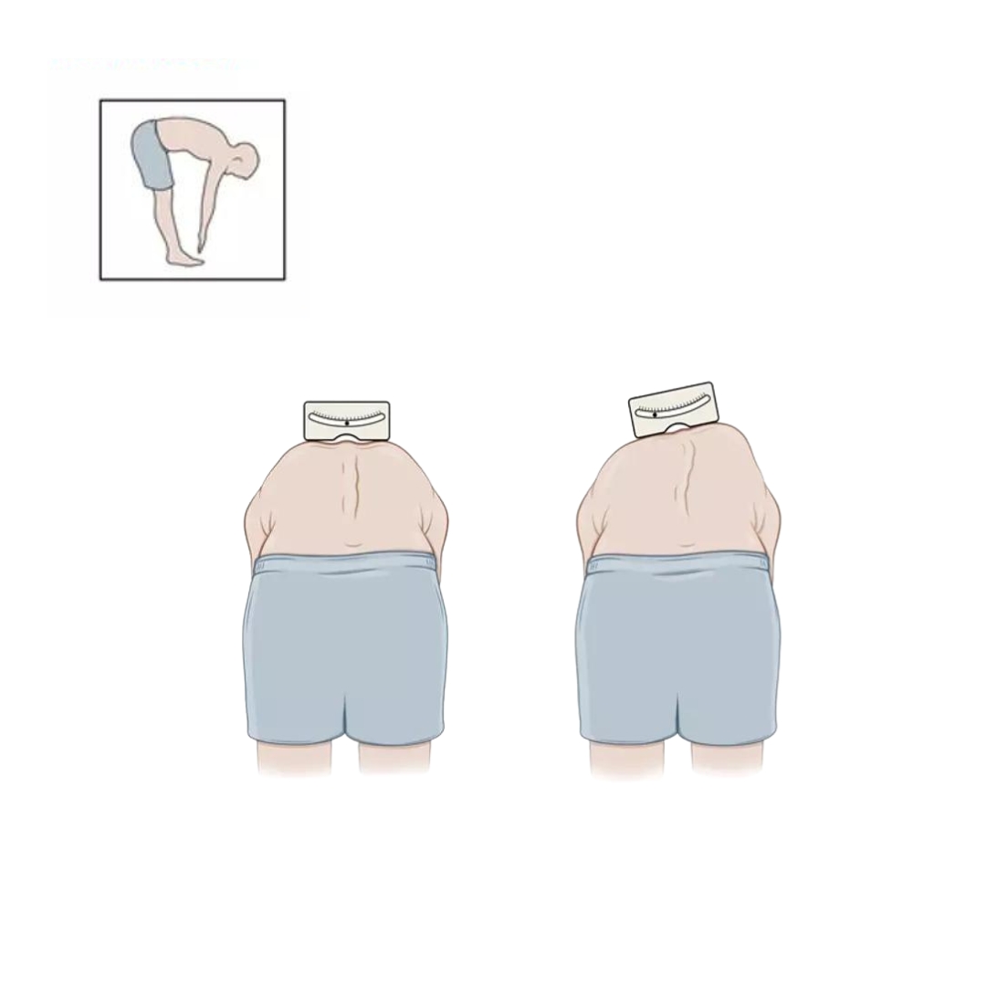 Σκολίωση - Physiotherapy & Rehab